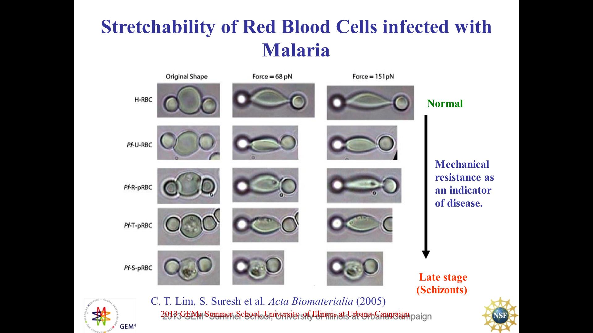 Stretchability of Red Blood Cells infected with Malaria