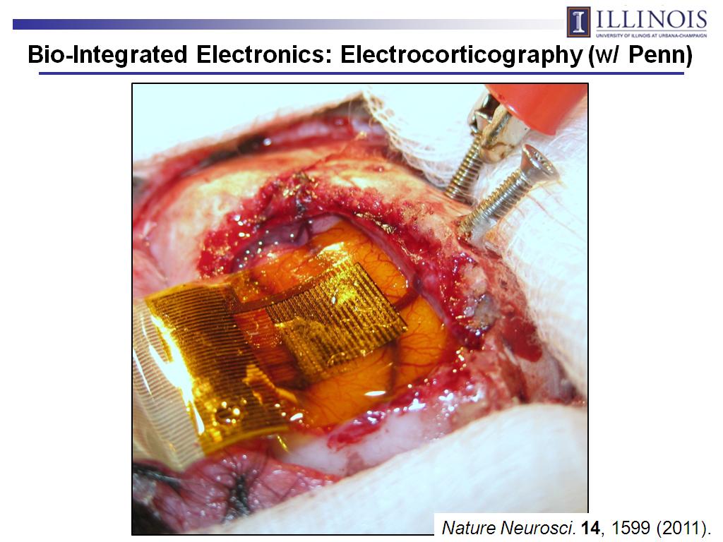 Bio-Integrated Electronics: Electrocorticography (w/ Penn)