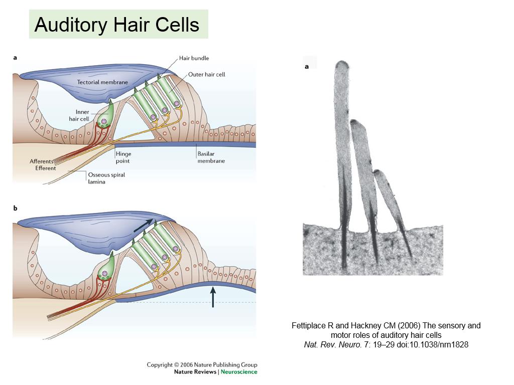 Auditory Hair Cells