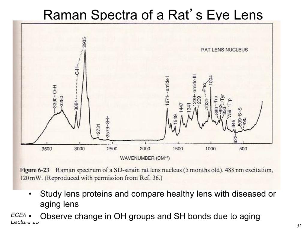 Raman Spectra of a Rat's Eye Lens