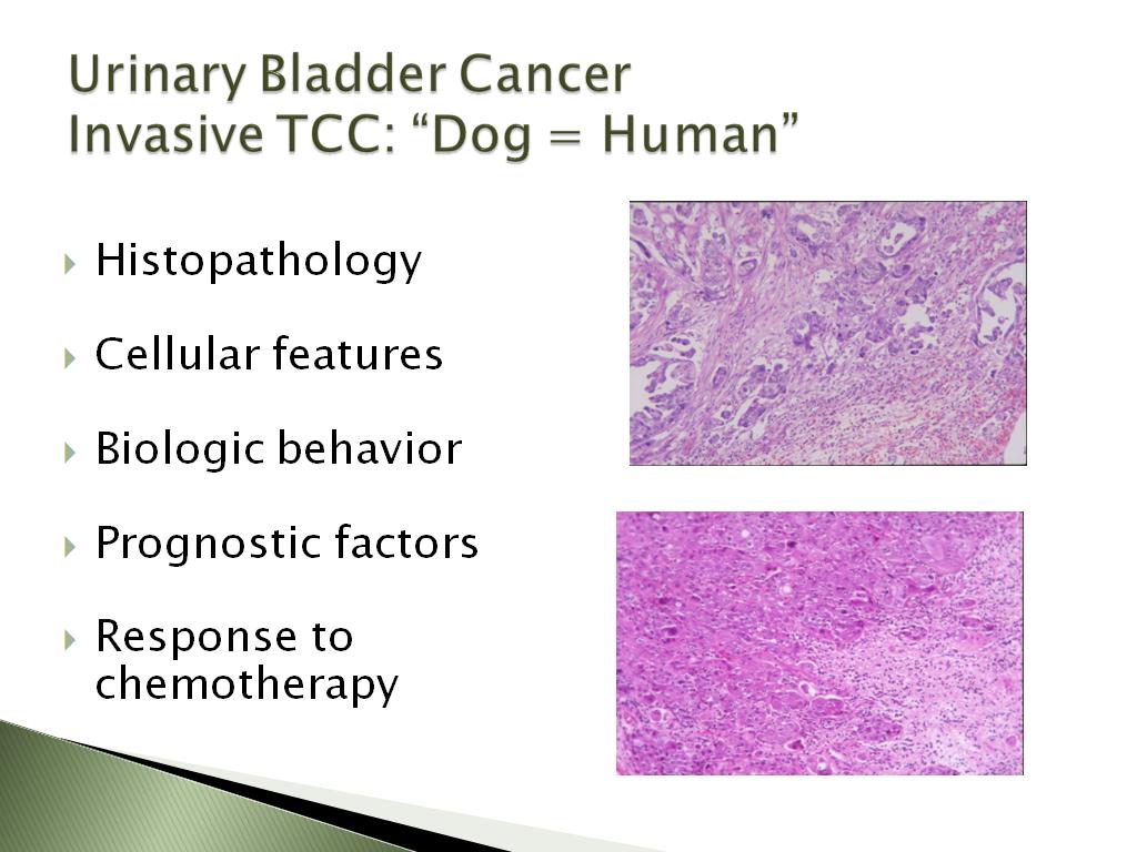 Urinary Bladder Cancer Invasive TCC: 