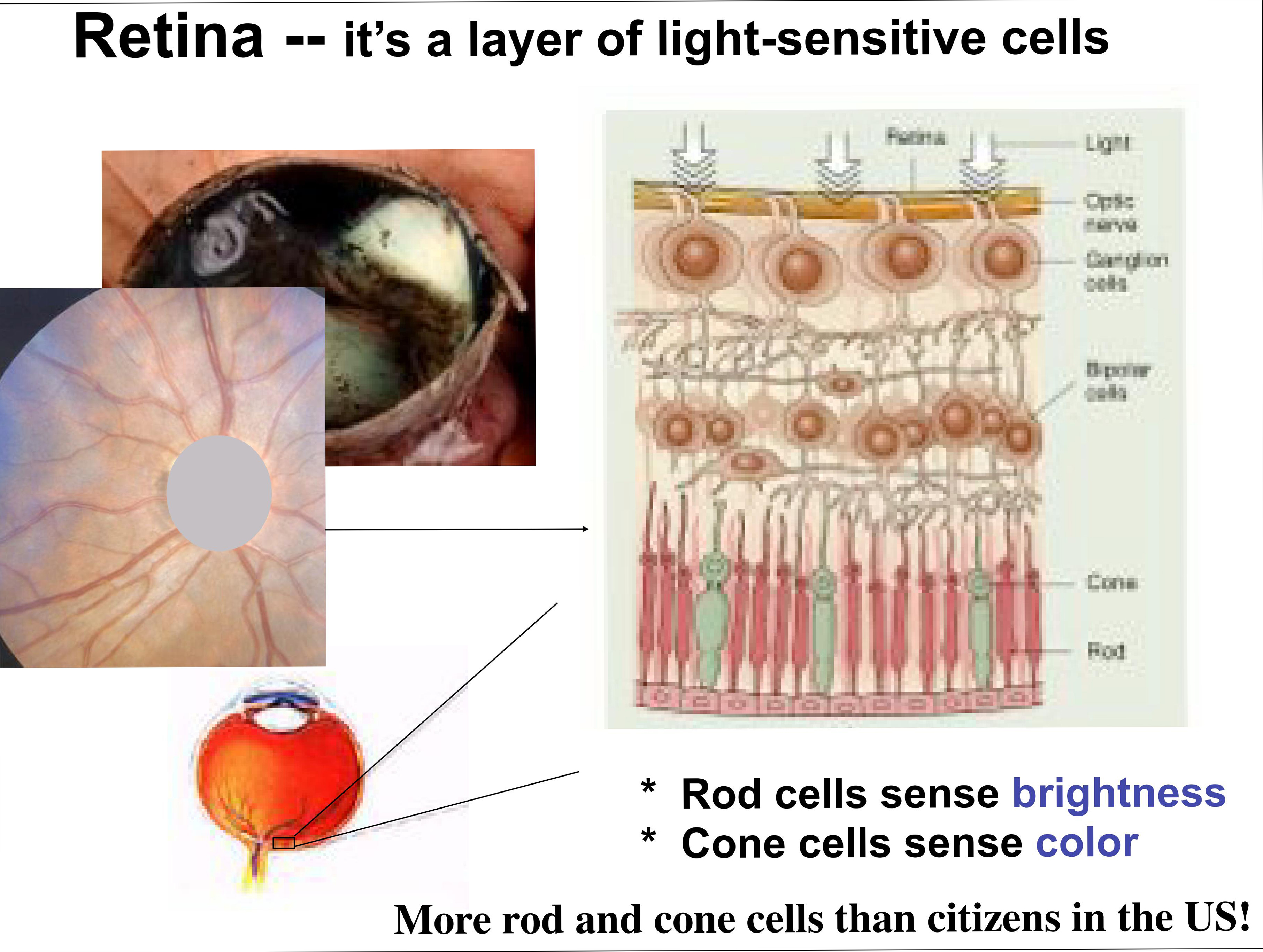 Retina -- It's a layer of light-sensitive cells