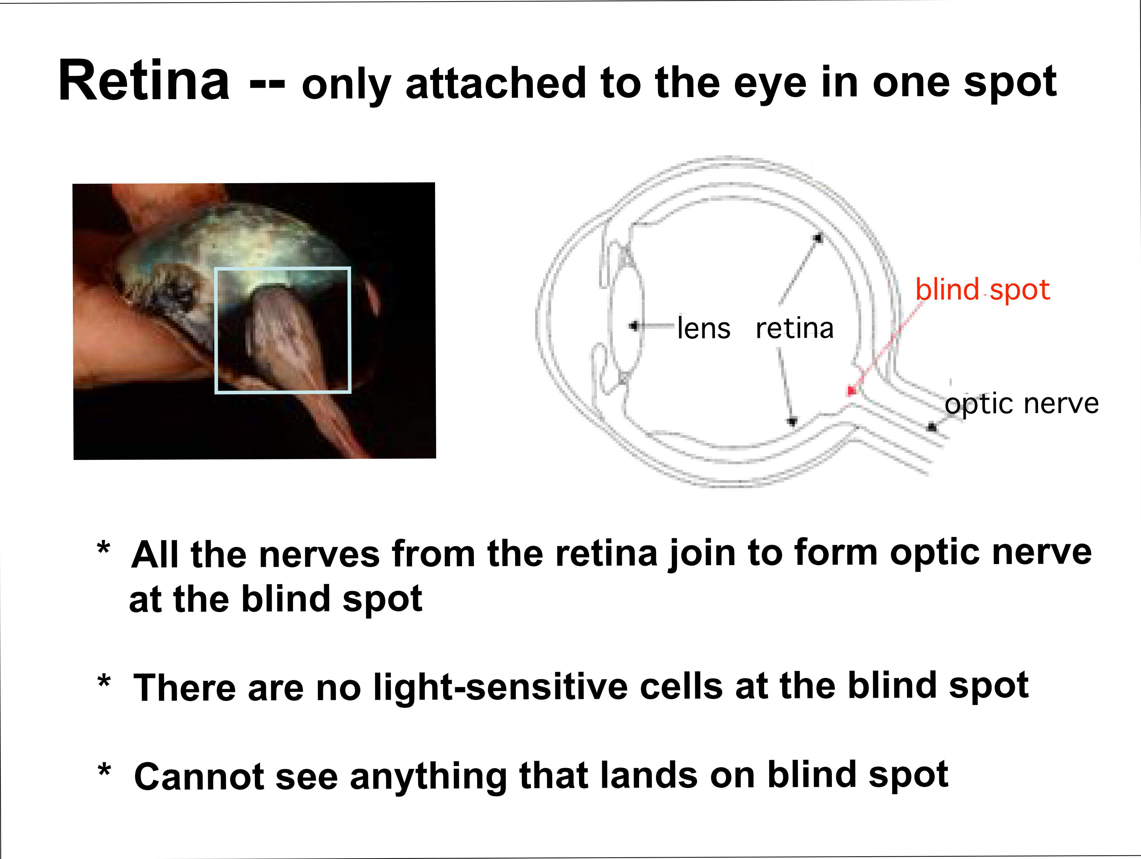 Retina -- only attached to the eye in one spot