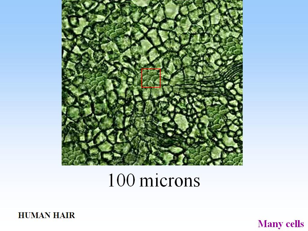 100 microns