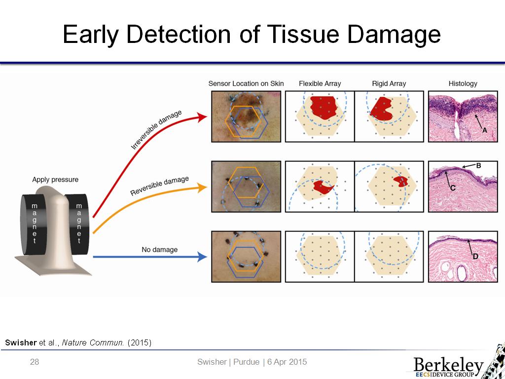 Early Detection of Tissue Damage