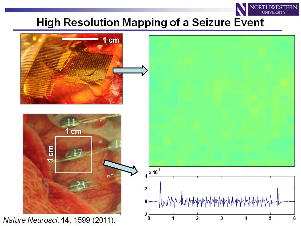 High Resolution Mapping of a Seizure Event