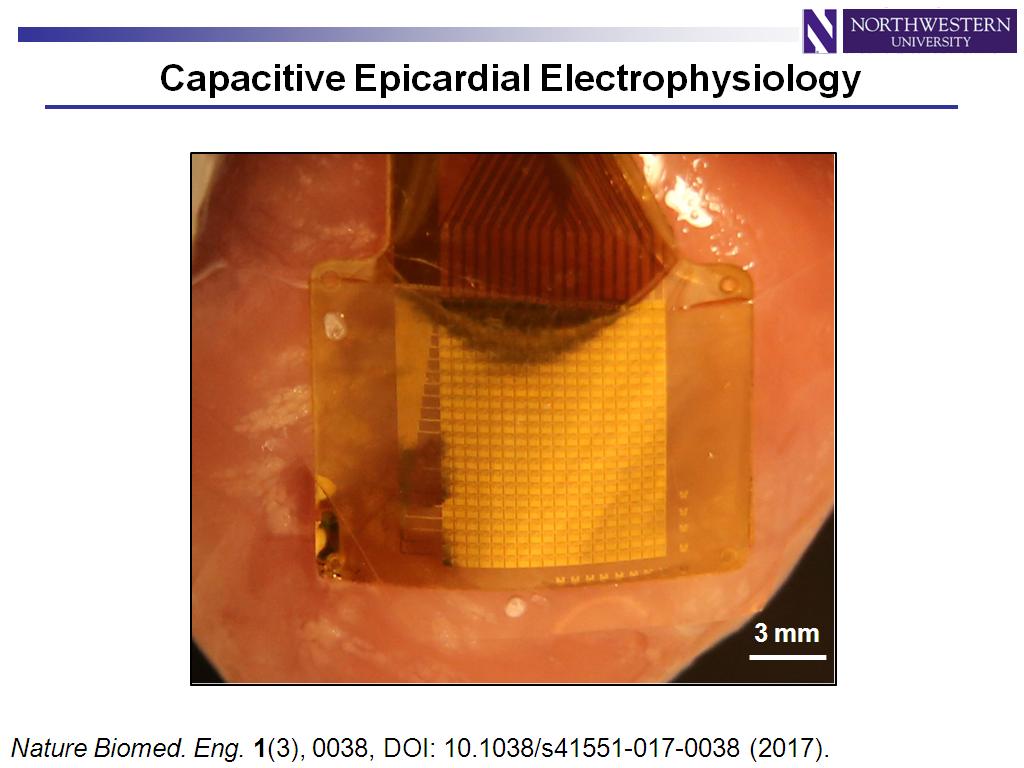 Capacitive Epicardial Electrophysiology