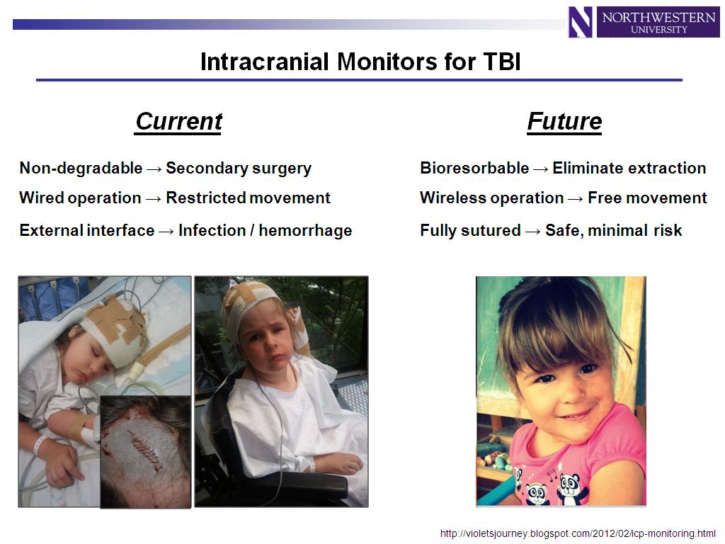 Intracranial Monitors for TBI