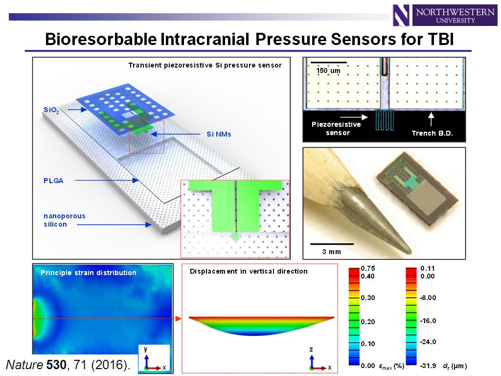 Bioresorbable Intracranial Pressure Sensors for TBI