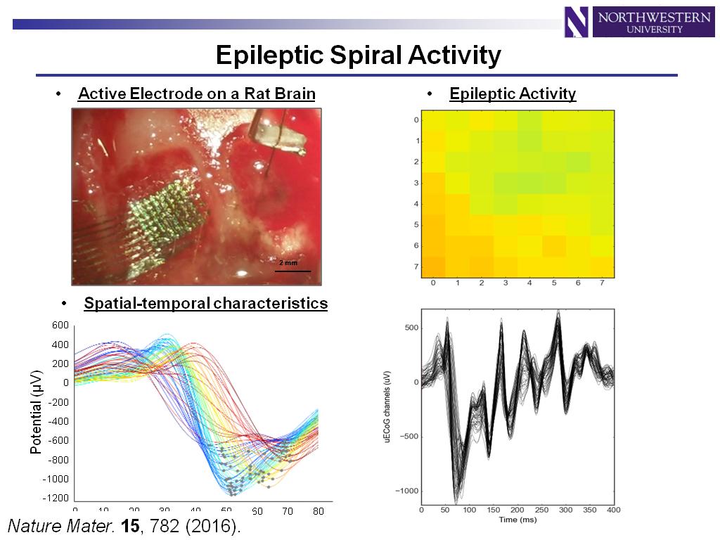 Epileptic Spiral Activity