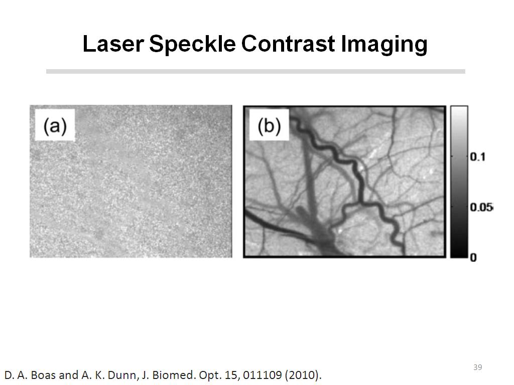 Laser Speckle Contrast Imaging