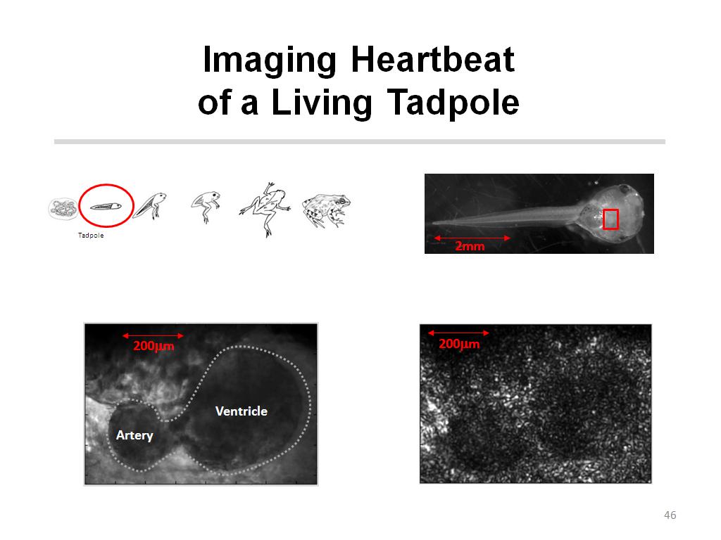 Imaging Heartbeat of a Living Tadpole