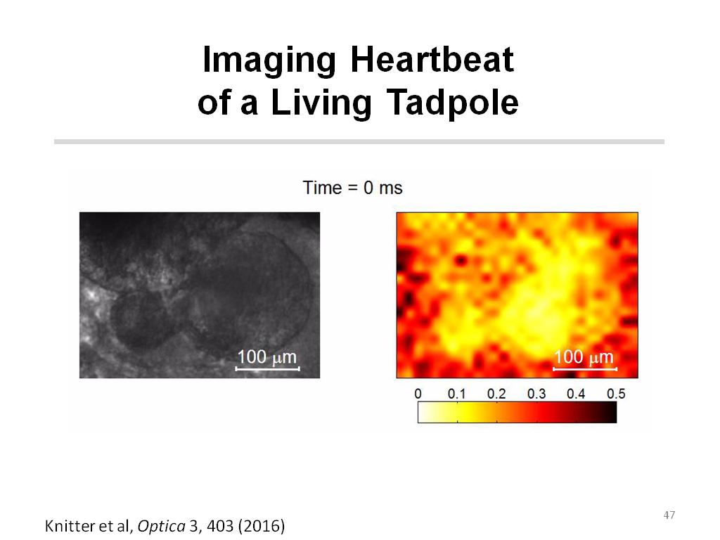 Imaging Heartbeat of a Living Tadpole