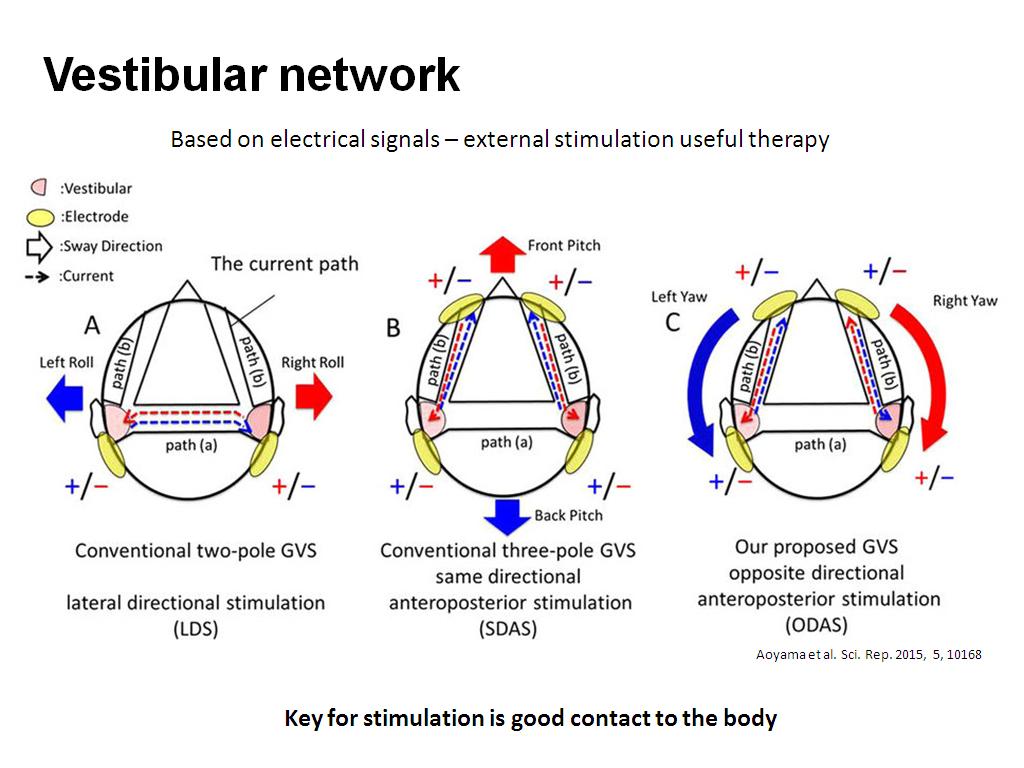 Vestibular network