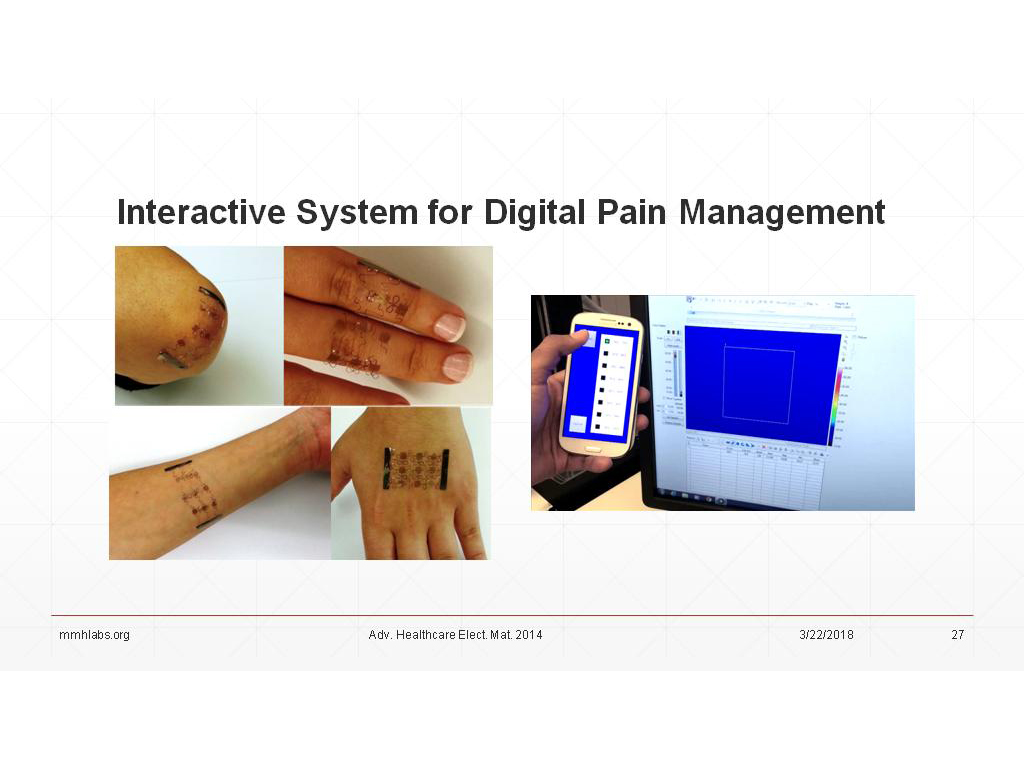 Interactive System for Digital Pain Management