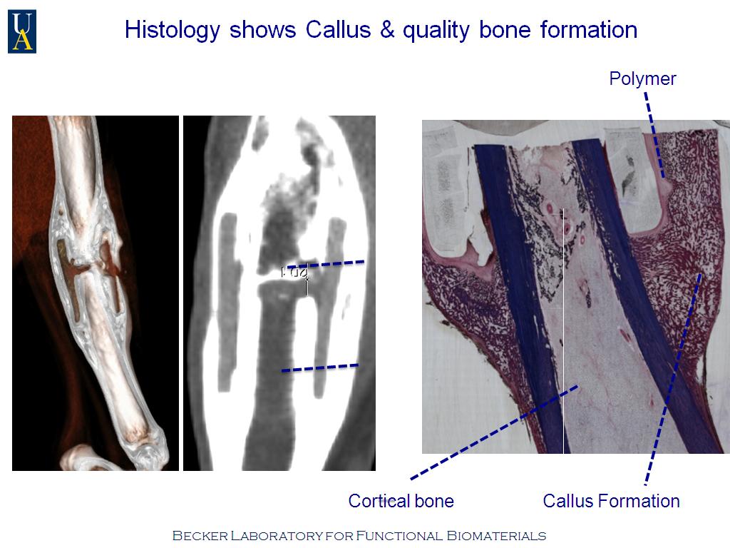 Histology shows Callus & quality bone formation