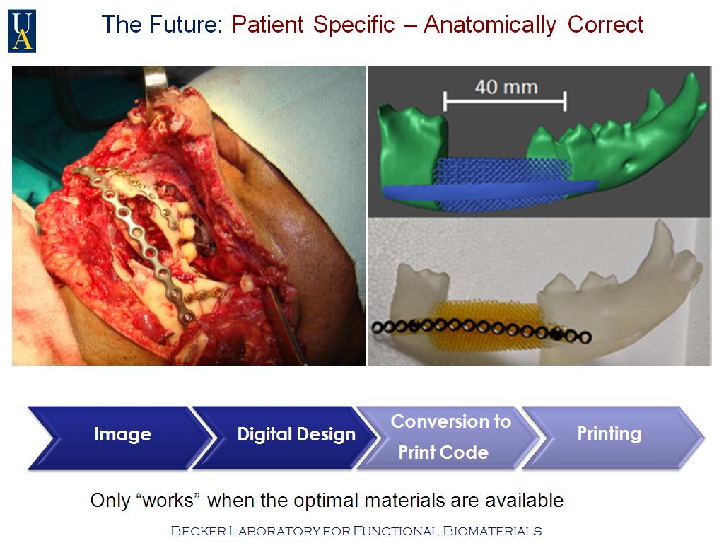 The Future: Patient Specific – Anatomically Correct