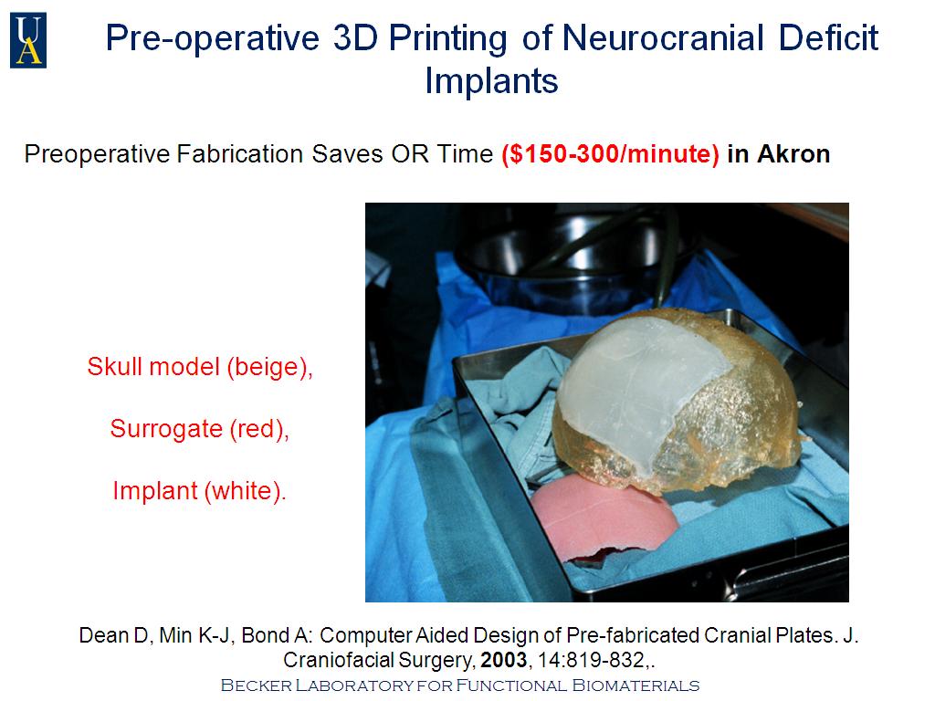 Pre-operative 3D Printing of Neurocranial Deficit Implants
