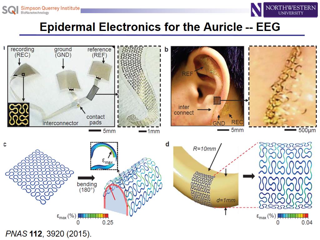 Epidermal Electronics for the Auricle -- EEG