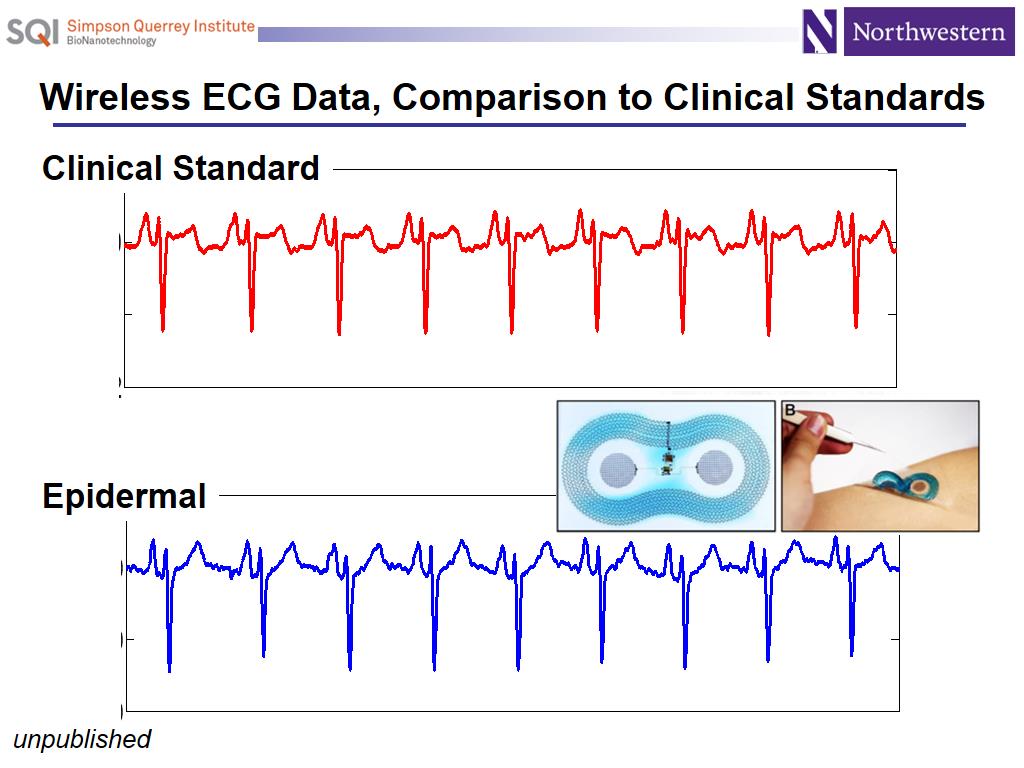 Wireless ECG Data, Comparison to Clinical Standards