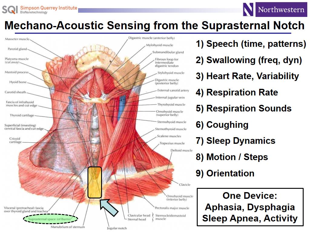 Mechano-Acoustic Sensing from the Suprasternal Notch