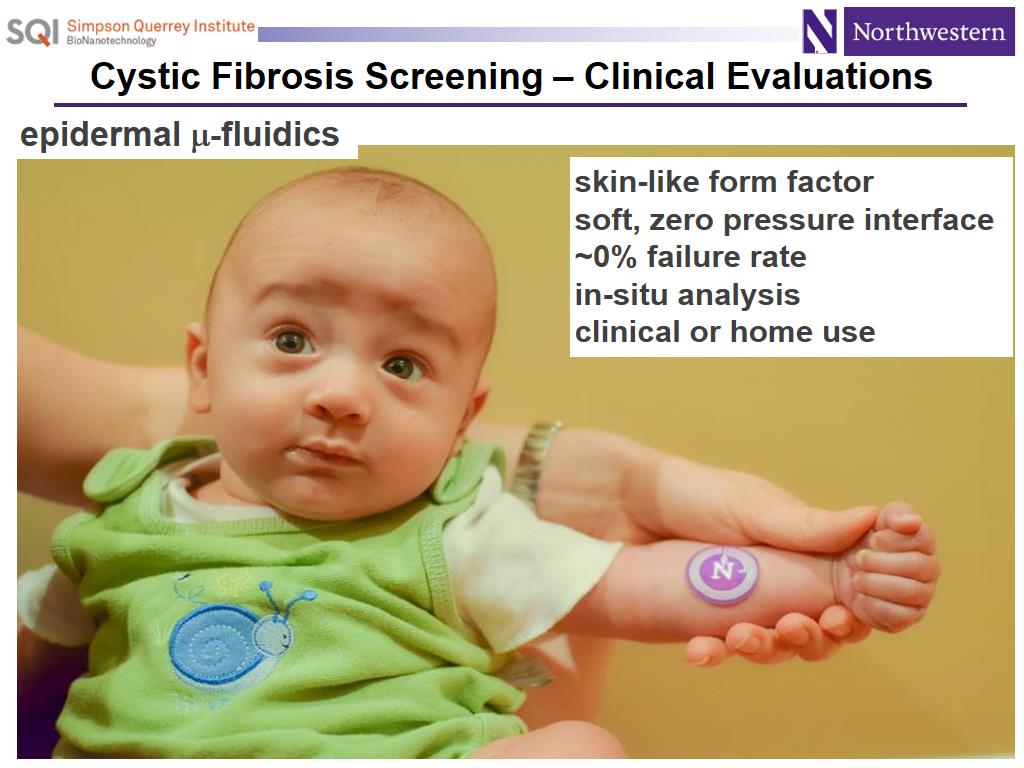 Cystic Fibrosis Screening – Clinical Evaluations