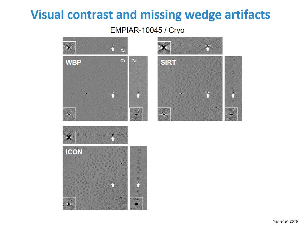 Visual contrast and missing wedge artifacts