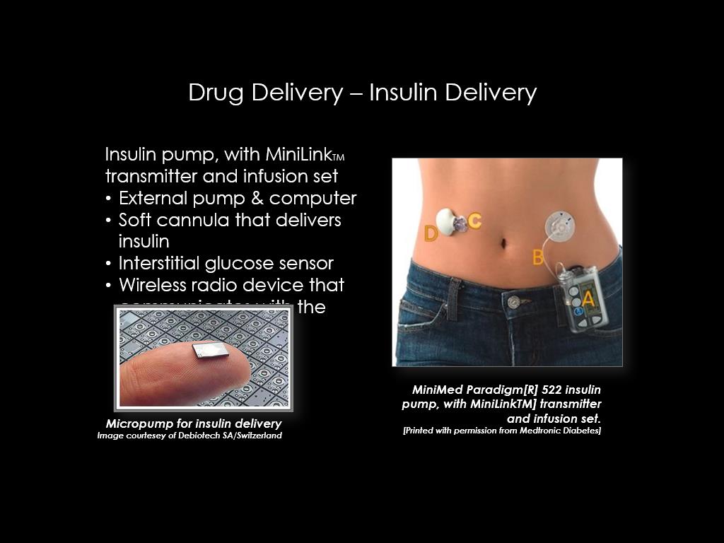 Drug Delivery – Insulin Delivery