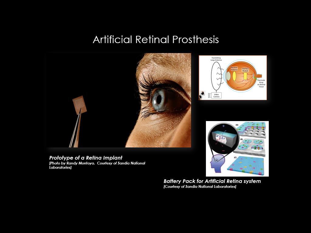 Artificial Retinal Prosthesis