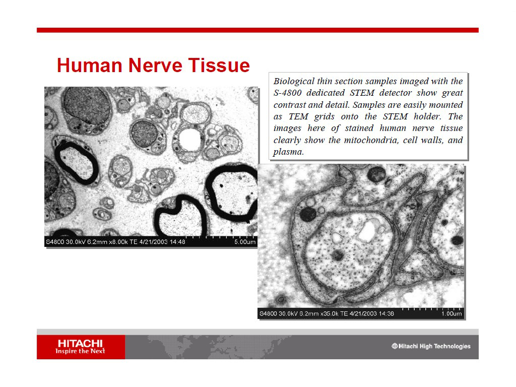 Human Nerve Tissue
