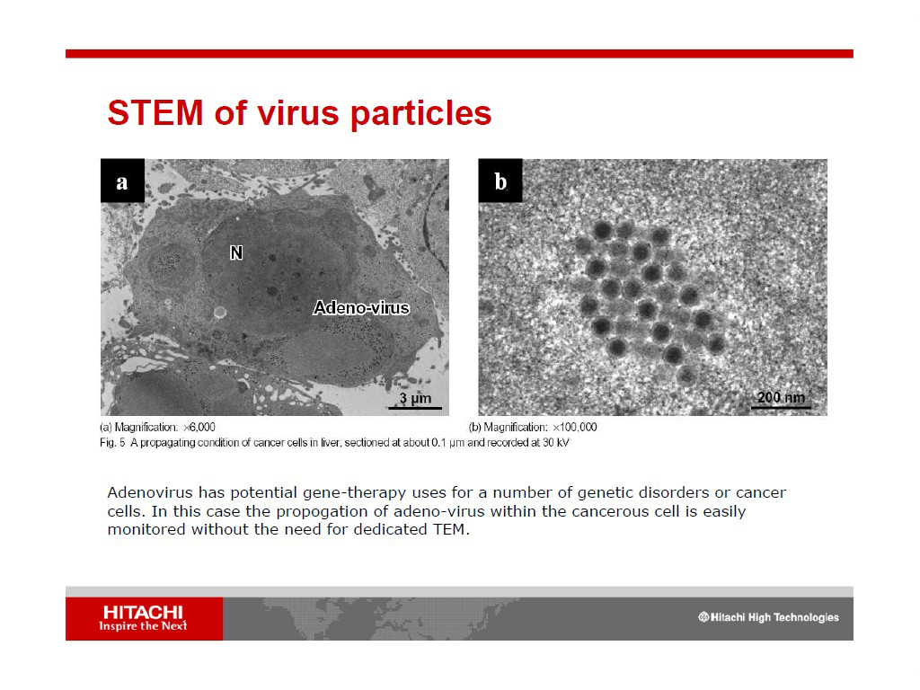 STEM of virus particles