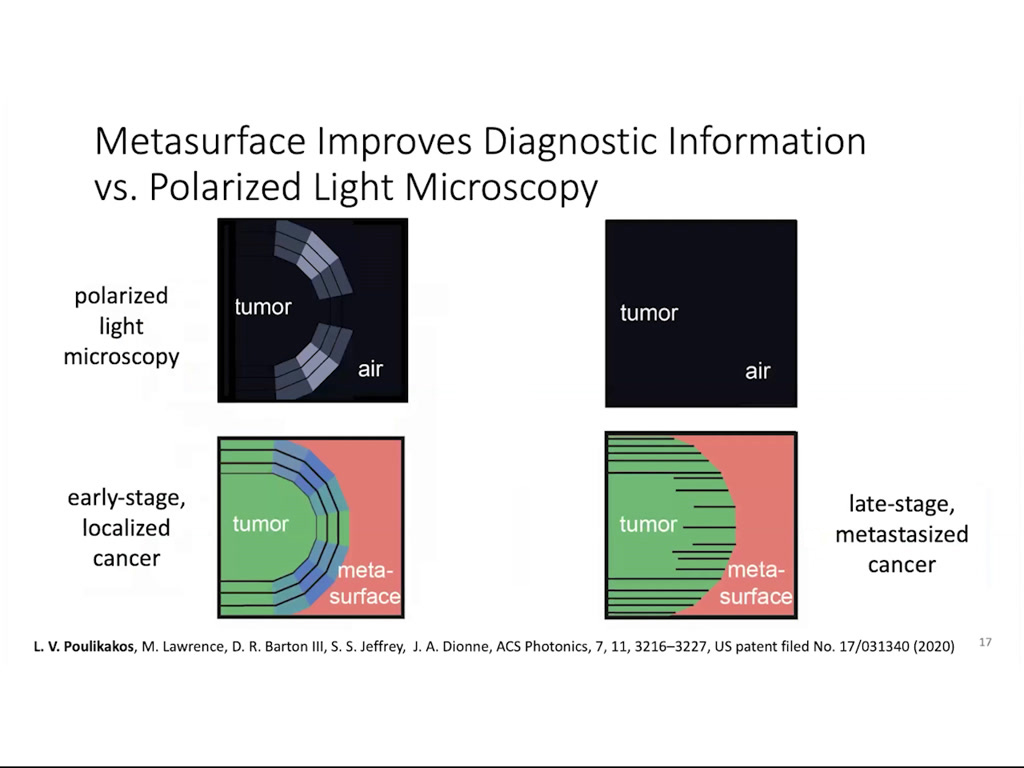 Metasurfaces Improves Diagnostic Information