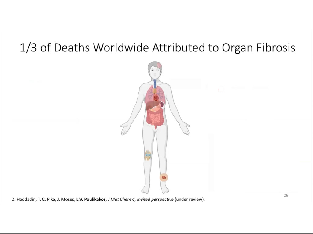 1/3 of Deaths Worldwide Attributed to Organ Fibrosis
